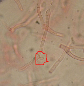 Alcuni ritrovamenti in lecceta